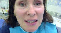 Лечение протезирование зубов в хуньчуне отзывы thumbnail