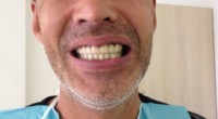 Лечение протезирование зубов в хуньчуне отзывы